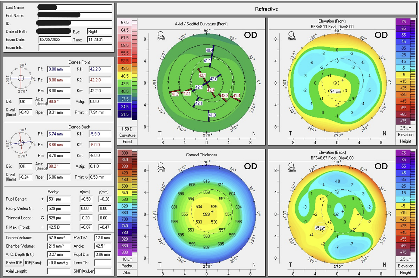Laser 247 Review: Features, Benefits, Pricing, and How to Use the Platform